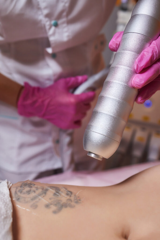 young woman undergoing laser tattoo removal procedure salon closeup